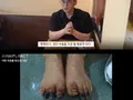 주작이라 의심 받았던 한의학 동상치료 ㄷ..jpg 썸네일